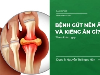 Bệnh Gút Nên Ăn Gì Và Kiêng Ăn Gì?