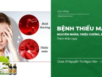 Bệnh Thiếu Máu: Nguyên Nhân, Triệu Chứng, Điều Trị