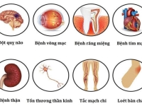 3 cách phòng tránh biến chứng tiểu đường dễ áp dụng mỗi ngày