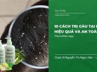 10 Cách Trị Gàu Tại Nhà Hiệu Quả và An Toàn