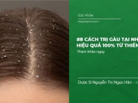 #8 Cách trị Gàu tại nhà hiệu quả 100% từ Thiên Nhiên