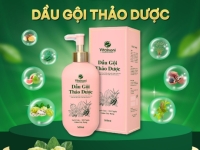 Dầu gội thảo dược Vitalnoni – Giải pháp giảm rụng tóc, sạch gàu từ thiên nhiên
