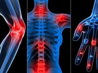 Cách sử dụng nước cốt nhàu Vitalnoni đúng cách cho người tiểu đường, huyết áp, xương khớp