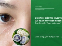 6 Cách trị Mụn Thịt an toàn, hiệu quả ngay tại nhà