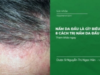Nấm da đầu là gì? Biểu hiện và #8 Cách Điều Trị nấm da đầu tại nhà