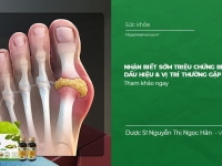 Nhận biết sớm Triệu Chứng Bệnh Gout: Dấu hiệu & Vị trí thường gặp