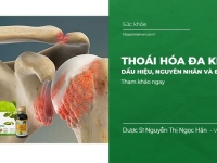 Thoái Hóa Đa Khớp: Dấu Hiệu, Nguyên Nhân và Điều Trị