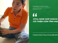 Vital Noni giúp khách hàng cải thiện Giãn tĩnh mạch chân - Vitalnoni.com