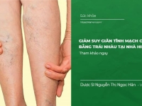 Cách giảm Suy Giãn Tĩnh Mạch chân bằng trái nhàu tại nhà