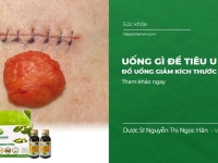 Uống Gì Để Tiêu U Mỡ | Đồ uống hỗ trợ giảm kích thước u mỡ