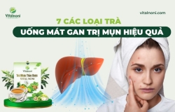 7 Các Loại Trà Uống Mát Gan Trị Mụn Hiệu Quả
