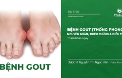 Bệnh Gout (Thống Phong) - Nguyên Nhân, Triệu Chứng & Điều Trị