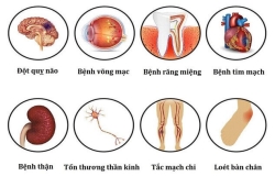 3 cách phòng tránh biến chứng tiểu đường dễ áp dụng mỗi ngày