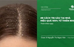 #8 Cách trị Gàu tại nhà hiệu quả 100% từ Thiên Nhiên