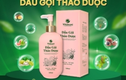 Dầu gội thảo dược Vitalnoni – Giải pháp giảm rụng tóc, sạch gàu từ thiên nhiên