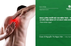 Đau lưng dưới bả vai bên Trái – Phải là dấu hiệu của bệnh gì?