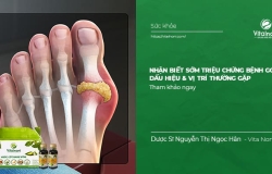 Nhận biết sớm Triệu Chứng Bệnh Gout: Dấu hiệu & Vị trí thường gặp