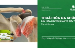 Thoái Hóa Đa Khớp: Dấu Hiệu, Nguyên Nhân và Điều Trị