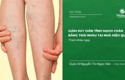 Cách giảm Suy Giãn Tĩnh Mạch chân bằng trái nhàu tại nhà