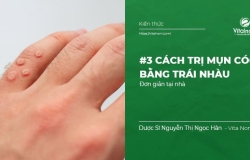 #3 cách Trị Mụn Cóc bằng Trái Nhàu đơn giản tại nhà