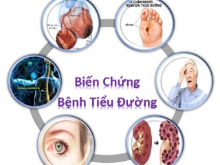 3 cách phòng tránh biến chứng tiểu đường dễ áp dụng mỗi ngày