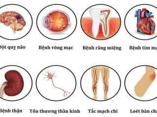 3 cách phòng tránh biến chứng tiểu đường dễ áp dụng mỗi ngày