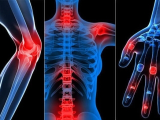 Cách sử dụng nước cốt nhàu Vitalnoni đúng cách cho người tiểu đường, huyết áp, xương khớp