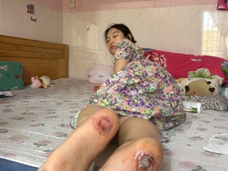 Chăm sóc tiểu đường theo hướng tự nhiên: lối sống bền vững và cách chọn sản phẩm hỗ trợ cùng Vitalnoni