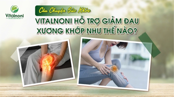 Video feedback về xương khớp