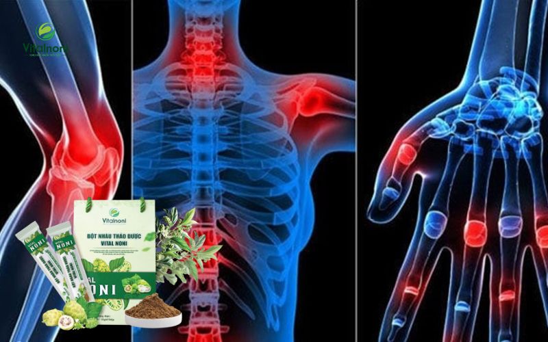 Hỗ trợ sức khỏe xương khớp và cơ chế giảm đau, kháng viêm