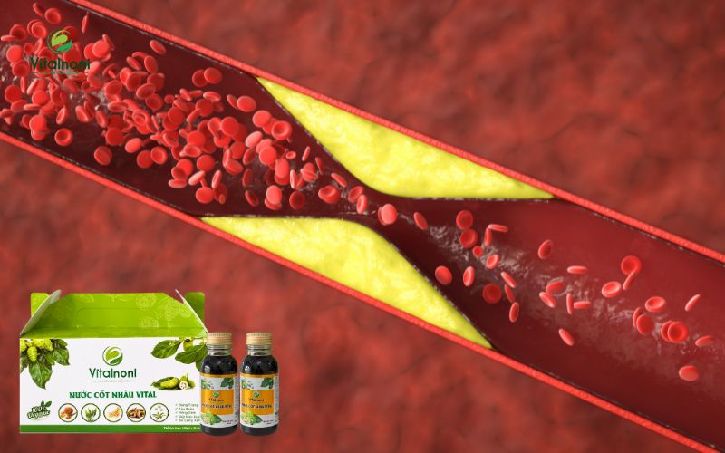 Trái Nhàu hỗ trợ cải thiện chỉ số cholesterol và ngăn ngừa xơ vữa động mạch