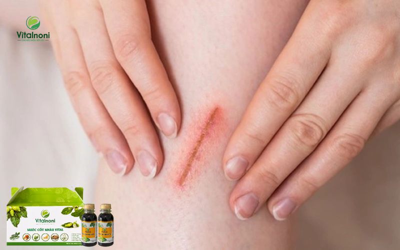 Người bị tiểu đường không nên xem nhẹ các vết xước hoặc vết thương trên da