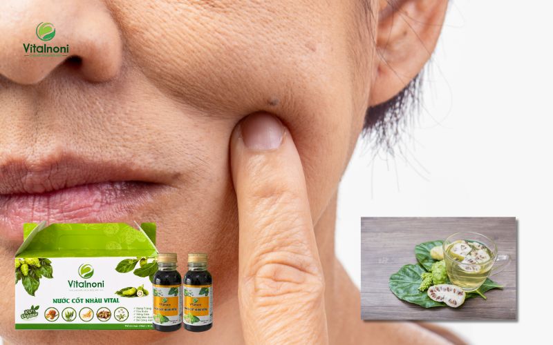 Trái nhàu chống oxy hóa, làm đẹp da và làm chậm lão hóa